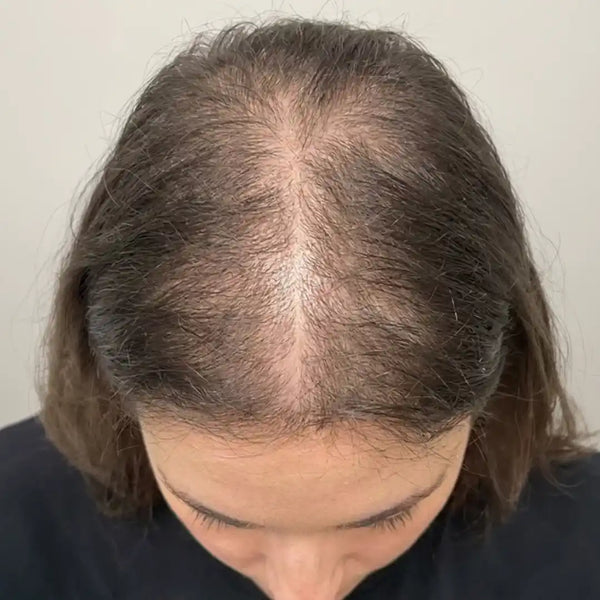 Before: Jennifer L.