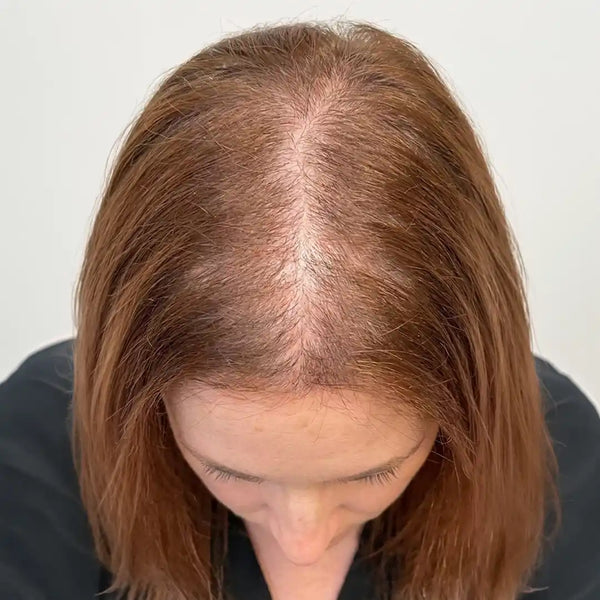 Before: Aisha R.