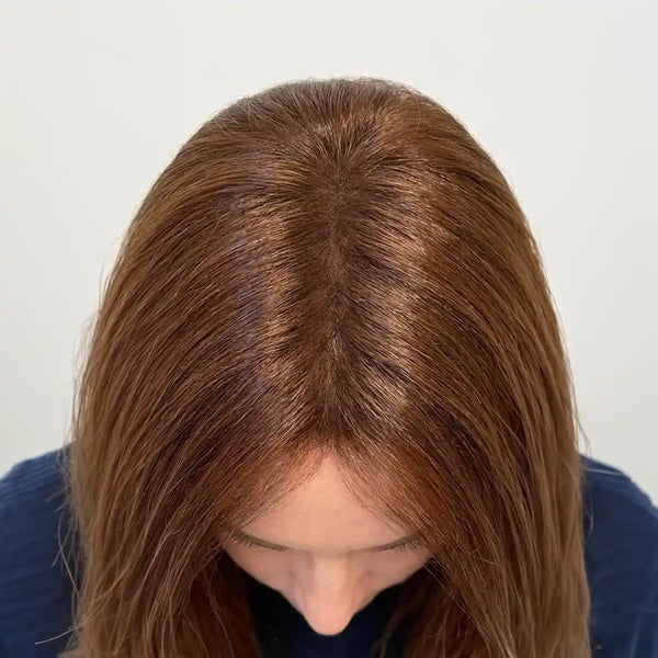 After: Aisha R.