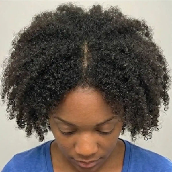 After: Chenelle S.
