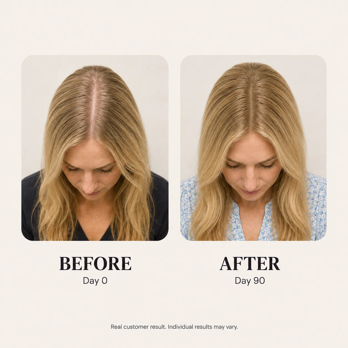 Hairvive Hair Growth Gummies