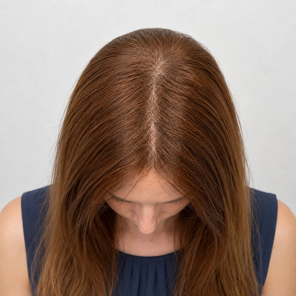 Before: Aisha R.