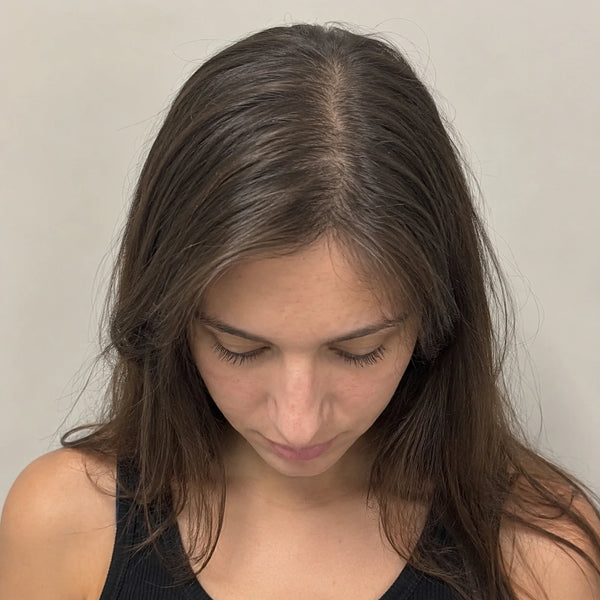 Before: Jennifer L.