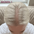 Hair Gummies
