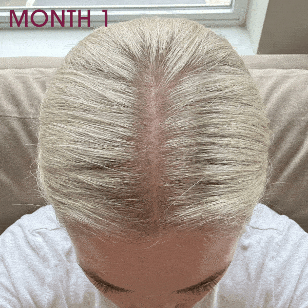 Hair Gummies