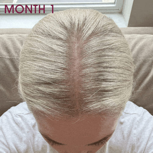 Hair Gummies